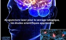 Acupuncture laser pour le sevrage tabagique, les Ã©tudes scientifiques approuvent