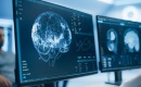 Arrêter de fumer rajeunit votre cerveau de 3 ans