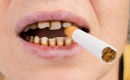 Tabac et perte de dents : les fumeurs ont 41 % de risque en plus
