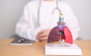 Cannabis et cancer du poumon : l'étude CHEST 2025 révèle un risque multiplié par 6
