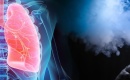 La cigarette Ã©lectroniqueâ¦ une bombe Ã  retardement pour les poumonsâ!