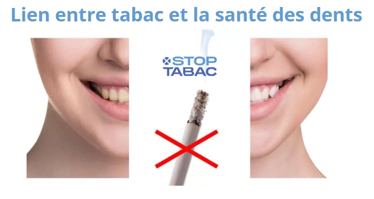 elfbar nachfüll pod läuft aus La cigarette électronique jaunit-elle les dents ?, On entend souvent que la  vape est “sans effet” sur les dents., La réalité est plus nuancée., → elle  contient moins de substances colorantes que la main image 0